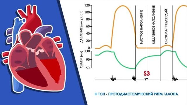 Видео порнуха #41520